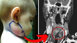 Ärzte sehen etwas aus dem Gesicht des Babys ragen, was sie entdecken ist schockierend!