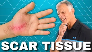 How to Get Rid of Scar Tissue After Surgery or Injury (Hardened?)