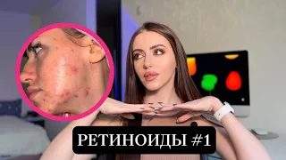 ДНЕВНИК РЕТИНОИДОВ #1 | Побочки, обострение акне, дерматит