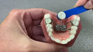 How to Turn Your Expander