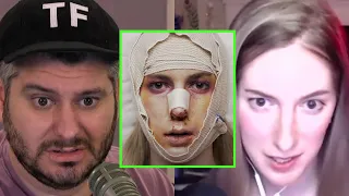 ContraPoints Talks On The Trauma Of Trans-Facial Surgery