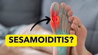 Sesamoiditis-Home Remedies- What is It? (Pain at the base  of Big Toe)