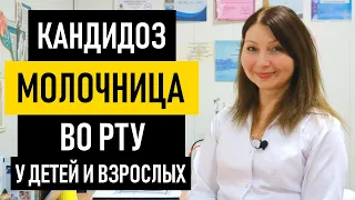 Молочница во рту: причины, симптомы и лечение. Как лечить кандидоз полости рта