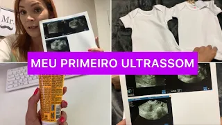 MEU PRIMEIRO ULTRASSOM ( TRANSVAGINAL) 4 SEMANAS E 5 DIAS / DIÁRIO DE GRAVIDEZ #3