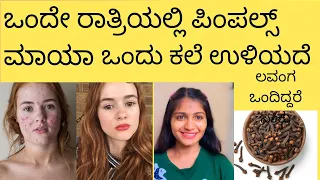 How To Remove Pimples Overnight  Acne Treatment | Anchor Priya | Pimples gone in 1 days Kannada