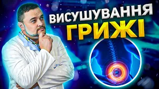 Висушування міжхребцевих гриж