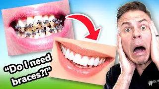 How To Tell If You Need BRACES! The ULTIMATE Braces Guide Ep. 1