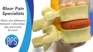 What's The Difference Between a Disc Bulge, Disc Protrusion & More - Common MRI Questions ANSWERED