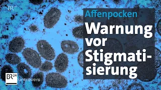 Virus-Erkrankung Affenpocken: Ist Deutschland vorbereitet? | Kontrovers | BR24