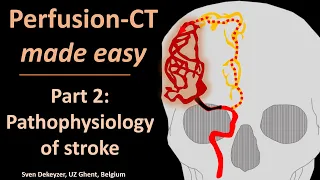 Perfusion CT made easy -  part 2 - pathophysiology of acute ischemic stroke