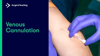 Intravenous (IV) Cannulation | An Essential Guide