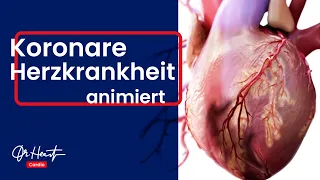Koronare Herzkrankheit - anschaulich animiert! | Dr. Heart