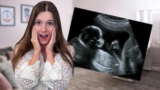 Seeing the Baby for the First Time *emotional*