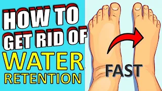 18 Powerful Home Remedies For Reducing Water Retention in The Body