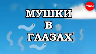 Мушки в глазах / Ted Ed на русском