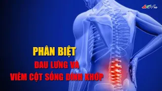 Phân biệt đau lưng và đau cột sống dính khớp | Truyền hình Hậu Giang