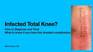 Infected Total Knee Replacement. A dreaded complication. What you need to know.