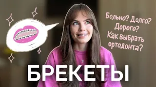 Брекеты. Долго? Дорого? Больно? Мой опыт: год после установки.