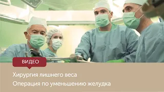 Бариатрическая операция: лапароскопическая продольная резекция желудка