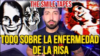 TODO SOBRE LA ENFERMEDAD DE LA RISA (THE SMILE TAPES)