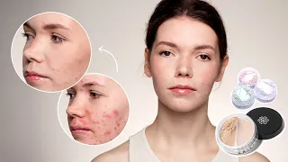 Правильная подготовка и макияж для проблемной кожи | Минеральная косметика и уход для кожи с акне