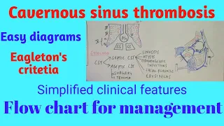 Cavernous sinus thrombosis