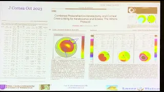 CXL, corneal diagnostics, Custom Ablations ASCRS 24