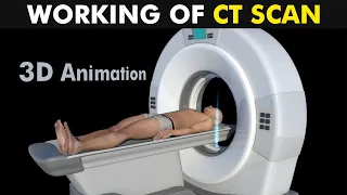 Working Of CT Scan 3D Animation (Urdu/Hindi)