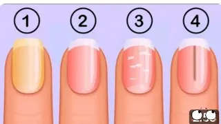 4 things your nails can tell you about your health #nails #instagram #viral #ai