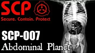 SCP-007 "Abdominal Planet" - SCP FOUNDATION - SCP Creatures