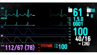 Electrocardiogram Monitor /// After Effects Template