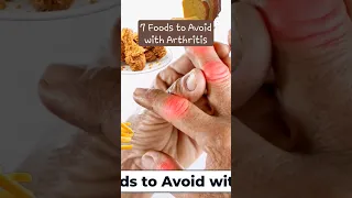 7 Foods to Avoid with Arthritis #food #healthyfood  #arthritis