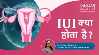 IUI क्या होता है? | All about Intrauterine insemination (IUI) | Gunjan IVF World, Delhi