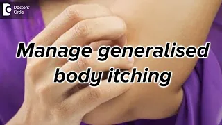 How to manage generalised itching? - Dr. Rasya Dixit