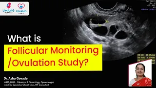 What is Follicular Monitoring/ Ovulation Study? | Dr. Asha Gavade | Umang Hospital | Pune