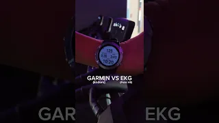 Garmin Watch Accuracy vs EKG #VO2max #Garmin #polar #heartratemonitor
