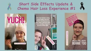 My Hair Loss From Chemo Experience & Short Side Effects Update