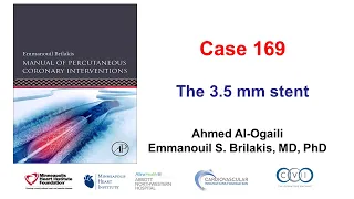 Case 169: Manual of PCI - The 3.5 mm stent