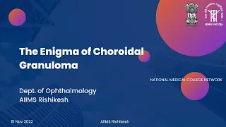 The Enigma of Choroidal Granuloma, Ophthalmology, 15. Nov. 2022, AIIMS Rishikesh