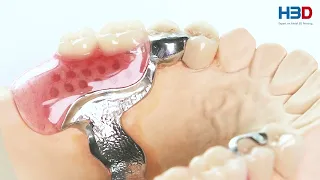 3D Printed Dental Parts Video