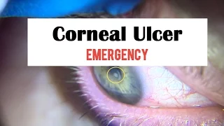 Corneal Ulcer Emergency