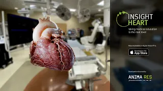 INSIGHT HEART on Apple Vision Pro