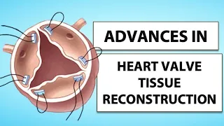 Patient Webinar: Advances in Heart Valve Tissue Reconstruction with Dr. Sell-Dottin & Dr. Shrestha