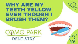 Como Park Dentistry - Why are my teeth yellow even though I brush them?