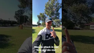 Magpie attack in Australia