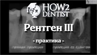 Как правильно делать прицельные снимки / How to Dentist