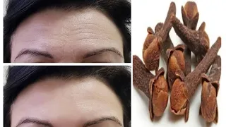 Mix cloves with water and wrinkles on the face and around the eyes will disappear immediately