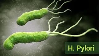 Helicobacter pylori identification, diagnosis and treatment