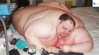 Patrick Deuel - 486kg || Heaviest People In Human History ||