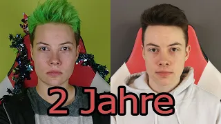 FTM - 2 Jahre Testosteron (Hormonersatztherapie)